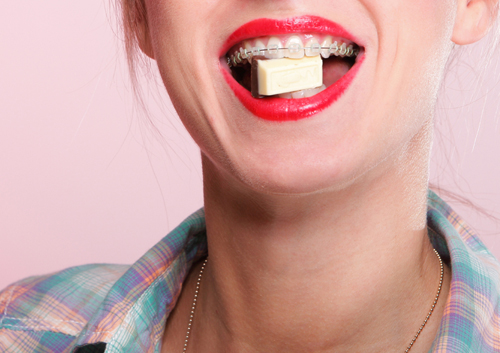 adult in orthodontic treatment learns 5 worst candies to eat